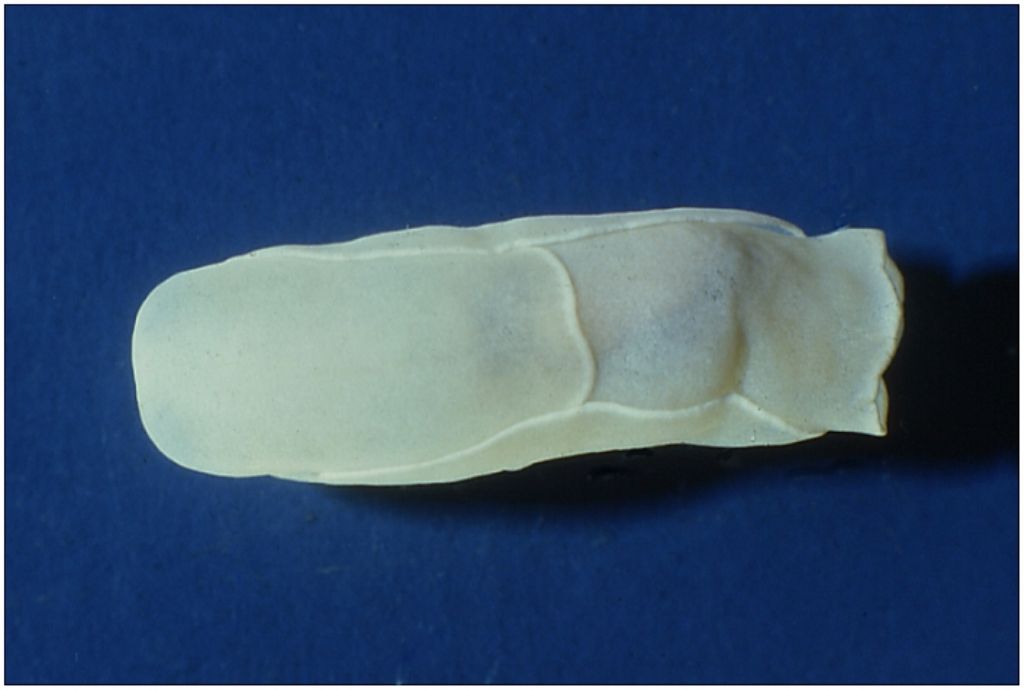 Philinopsis miqueli Pelorce, Horst & Orarau, 2013